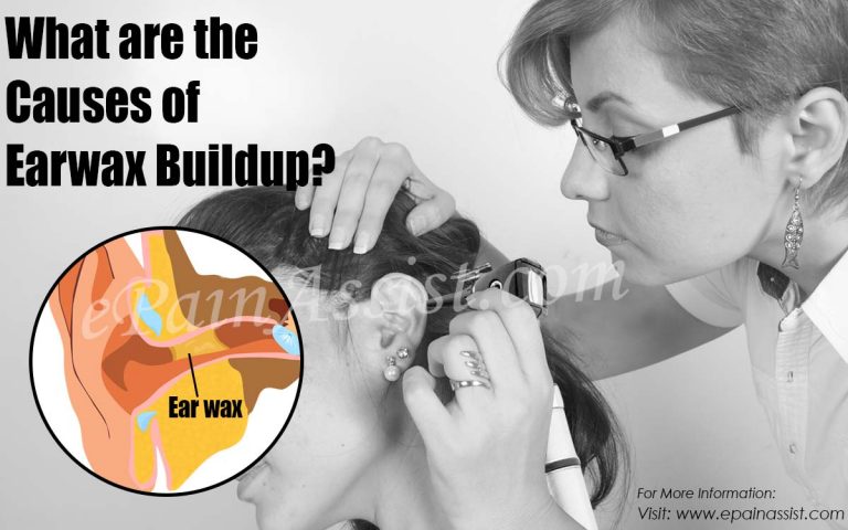 What are the Causes of Earwax Buildup & Ways to Get Rid of it?