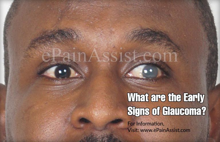 What are the Early Signs of Glaucoma?