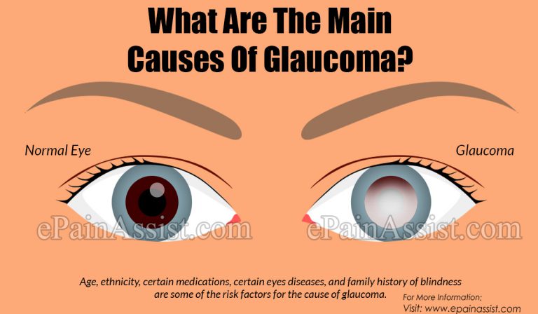 What Are The Main Causes Of Glaucoma?