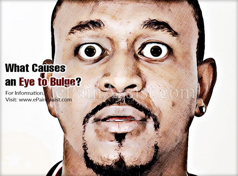 What Causes the Eyes to Bulge?