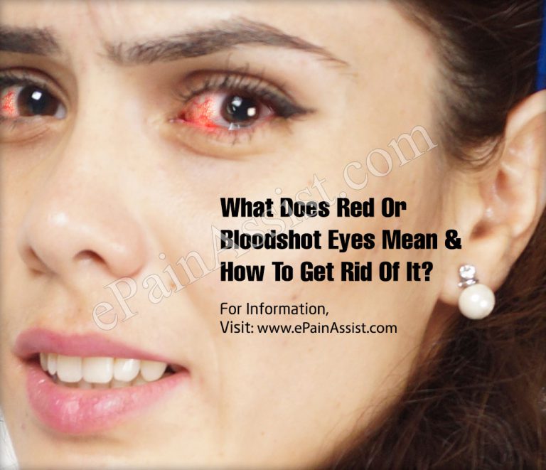 What Does Red Or Bloodshot Eyes Mean & How To Get Rid Of It?