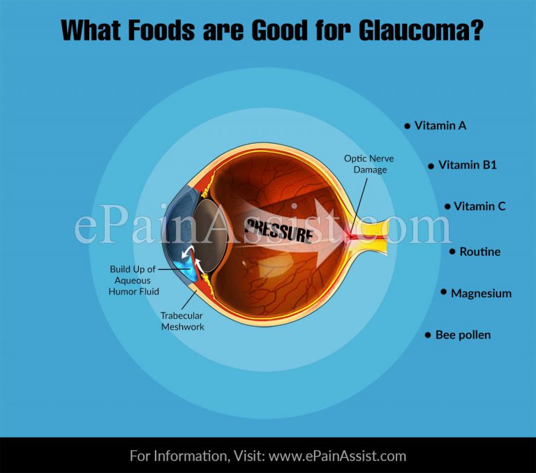 What Foods are Good for Glaucoma?