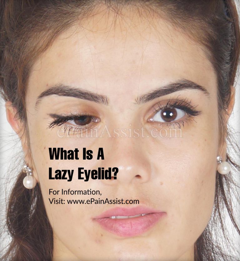 What Is A Lazy Eyelid?