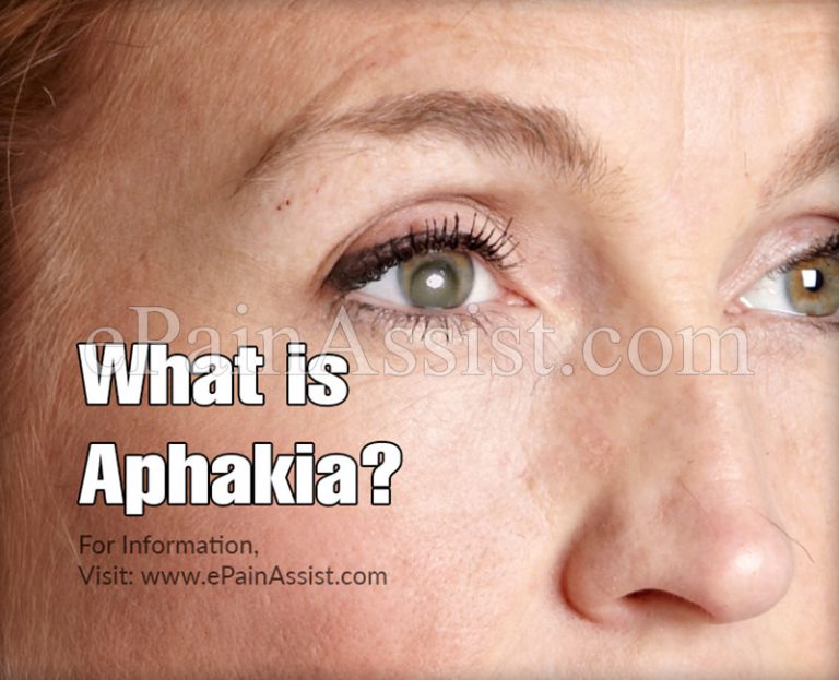 What is Aphakia : Causes, Risk Factors, Treatment, Complications, Characteristics