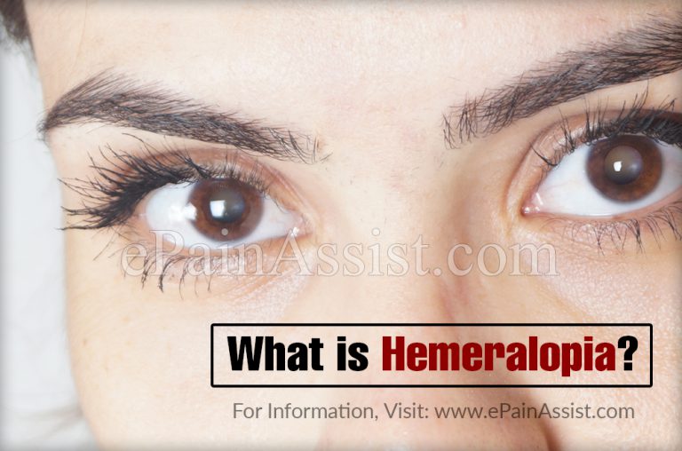 What is Hemeralopia & How is it Treated? | Causes, Symptoms, Prevention of Hemeralopia