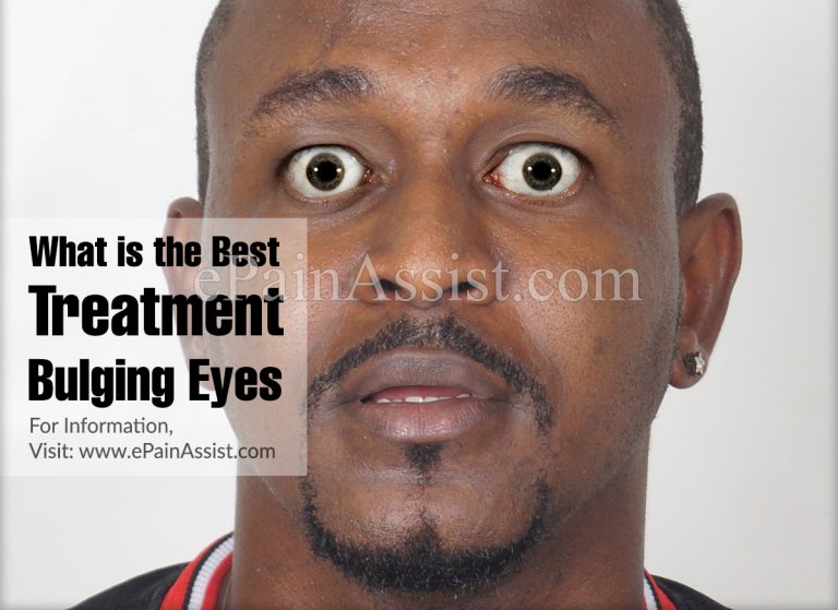 What is the Best Treatment for Bulging Eyes?