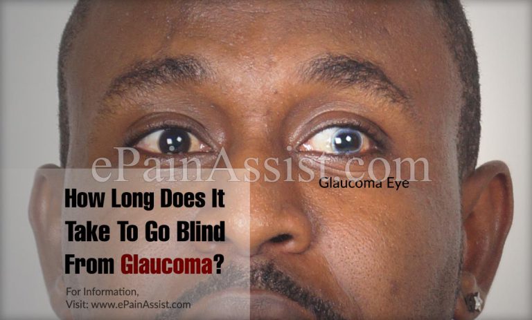 How Long Does It Take To Go Blind From Glaucoma?