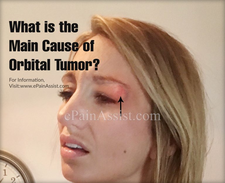 What is the Main Cause of Orbital Tumor?