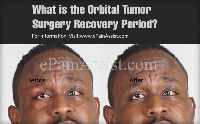 What is the Orbital Tumor Surgery Recovery Period?
