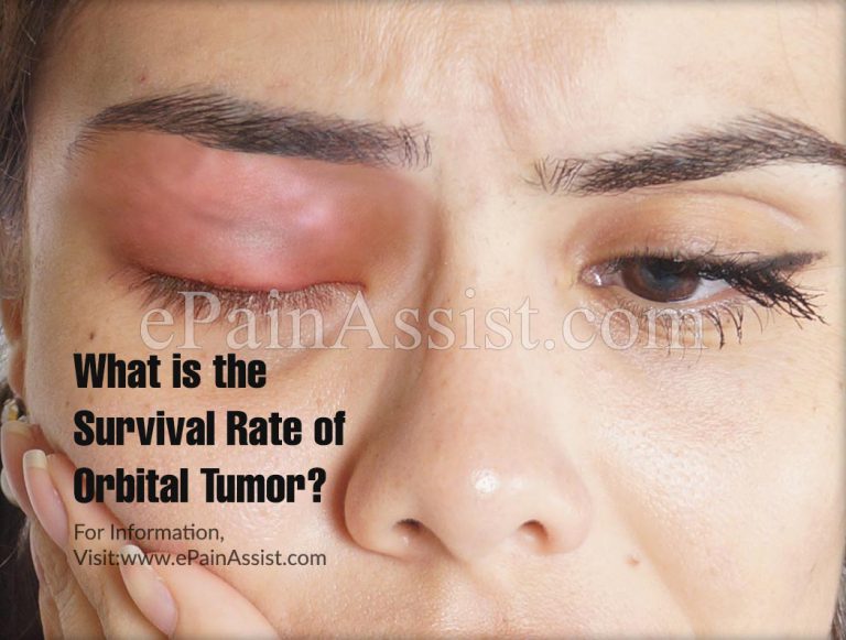 What is the Survival Rate of Orbital Tumor?