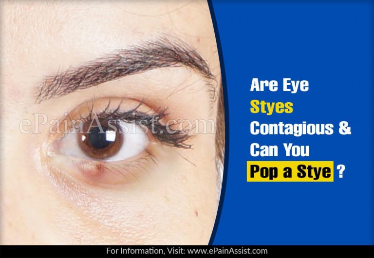 Are Eye Styes Contagious & Can You Pop a Stye?