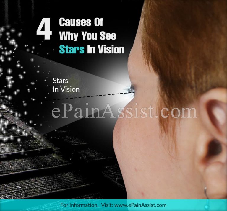 4 Causes Of Seeing Stars In Vision