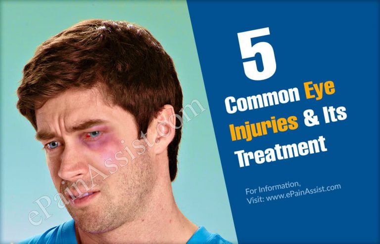 5 Common Eye Injuries & Its Treatment