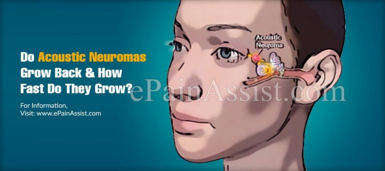 Do Acoustic Neuromas Grow Back & How Fast Do They Grow?