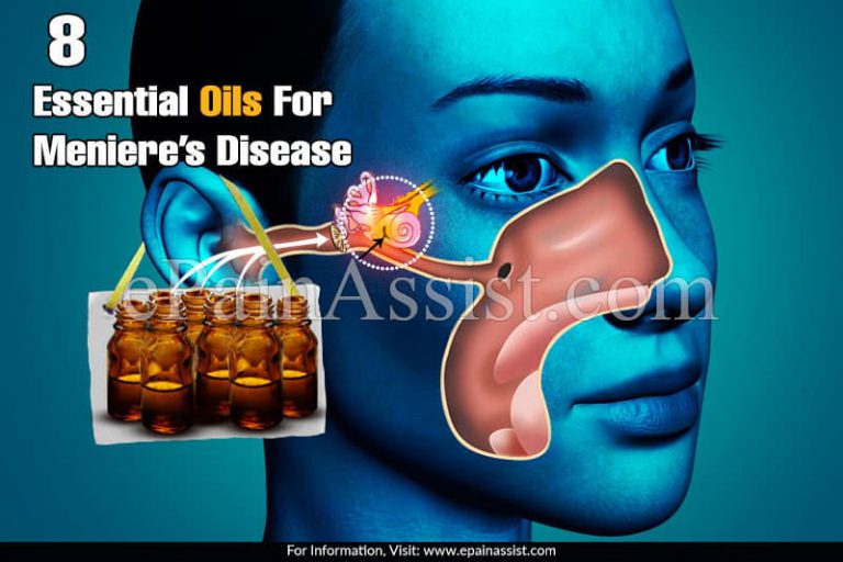 Essential Oils For Meniere’s Disease