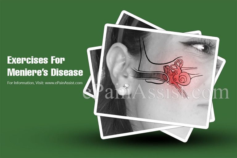 Exercises For Meniere’s Disease