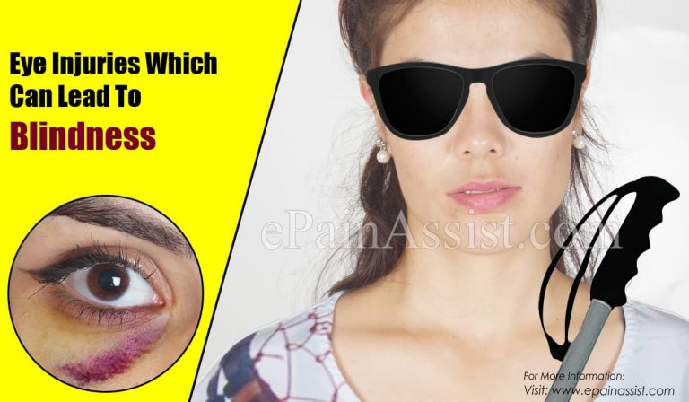 Eye Injuries Which Can Lead To Blindness