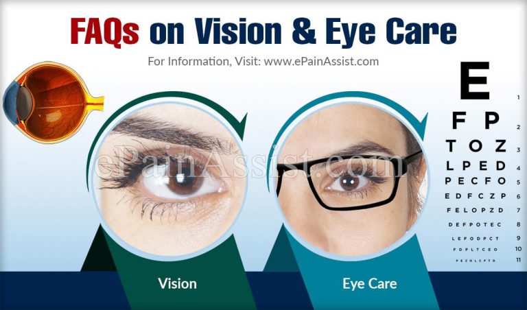 FAQs on Vision & Eye Care