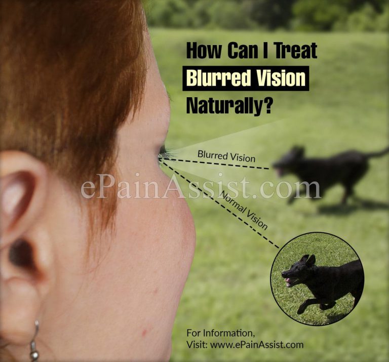 How Can I Treat Blurred Vision Naturally?