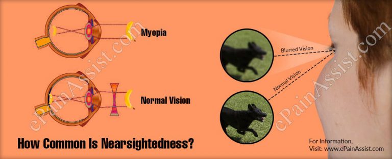How Common Is Nearsightedness Or It Is Rare Disease?