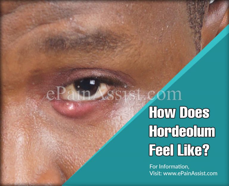How Does Hordeolum Feel Like?