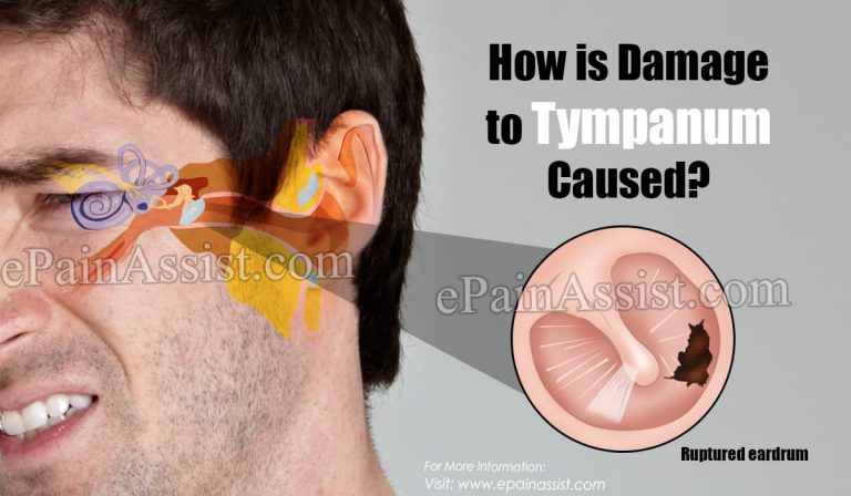 How is Damage to Tympanum Caused & Does a Damaged Tympanum Need a Surgery?