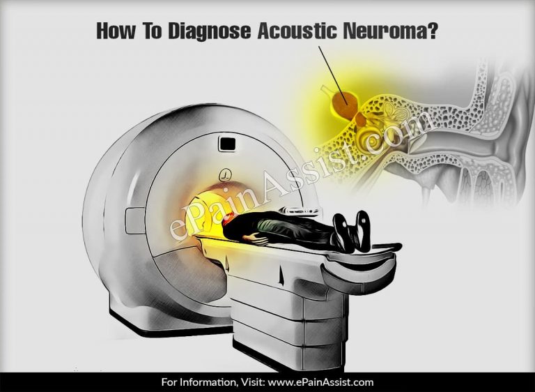 How To Diagnose Acoustic Neuroma & What Is The Best Medicine For It?