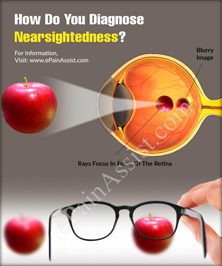 How To Diagnose Nearsightedness & What Is The Best Medicine For It?