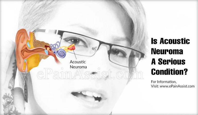 Is Acoustic Neuroma A Serious Condition & Can It Be Reversed?