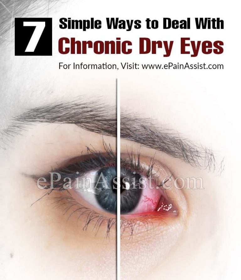 7 Simple Ways to Deal With  Chronic Dry Eyes