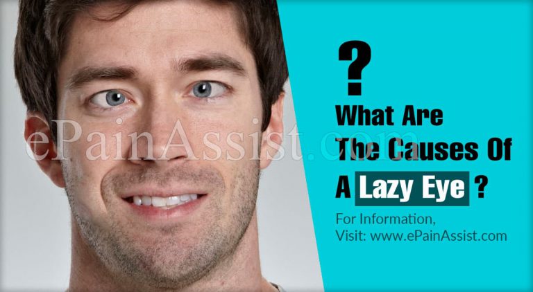 What Are The Causes Of A Lazy Eye?