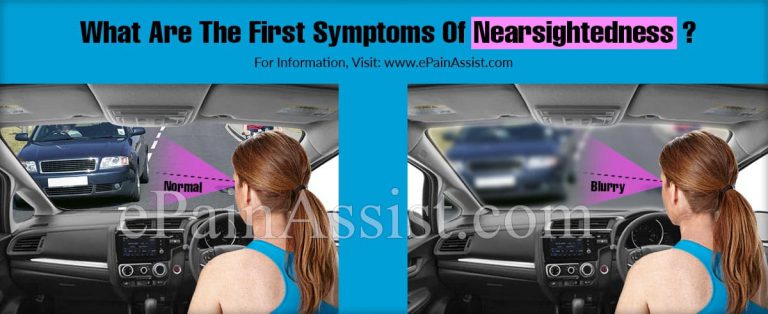 What Are The First Symptoms Of Nearsightedness & How Do You Test For It?