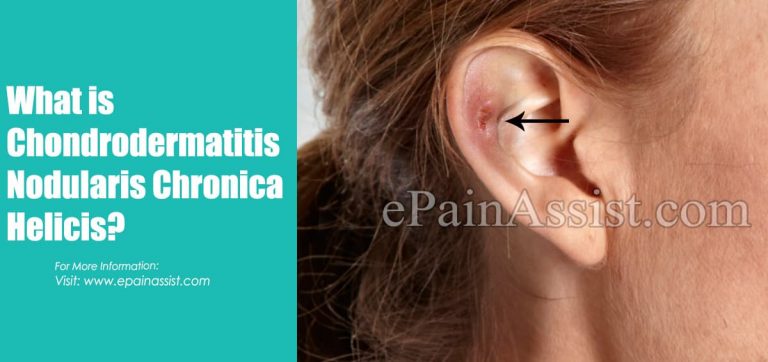 What Are The Presenting Features Of Chondrodermatitis Nodularis Helicis And How To Treat It?