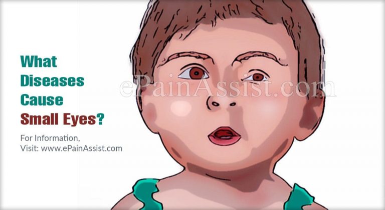 What Diseases Cause Small Eyes?