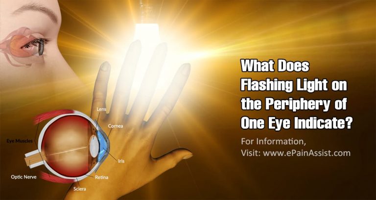 What Does Flashing Light on the Periphery of One Eye Indicate?