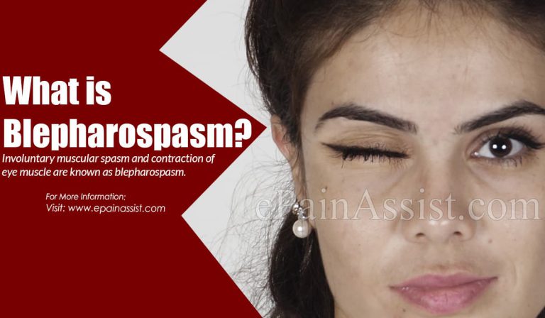 What Is Blepharospasm & What Are Its Types?