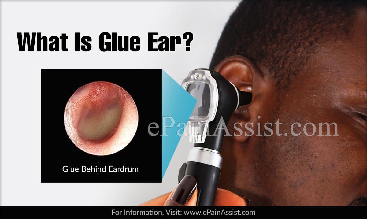 What Is Glue Ear?