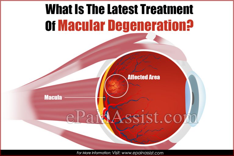 What Is The Latest Treatment Of Macular Degeneration?