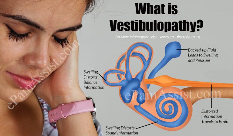 What Is Vestibulopathy, Know Its Causes, Symptoms, Diagnosis, Treatment
