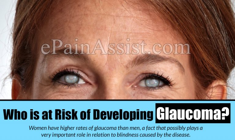 Who is at Risk of Developing Glaucoma?