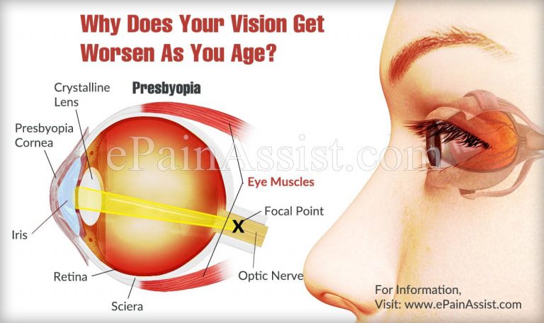 Why Does Your Vision Get Worsen As You Age?