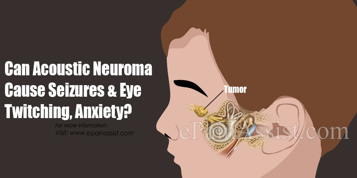 Can Acoustic Neuroma Cause Seizures & Eye Twitching, Anxiety?