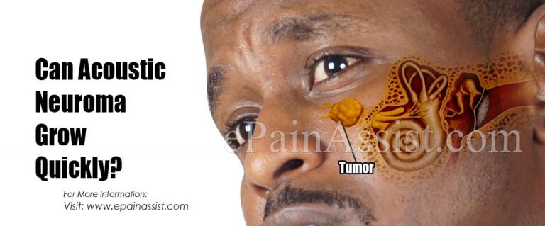 Can Acoustic Neuroma Grow Quickly & Can It Stop Growing?