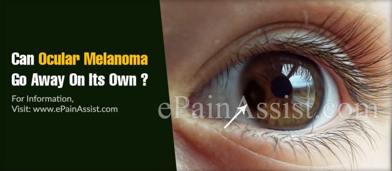 What Leads To Ocular Melanoma & Can It Be Cured?
