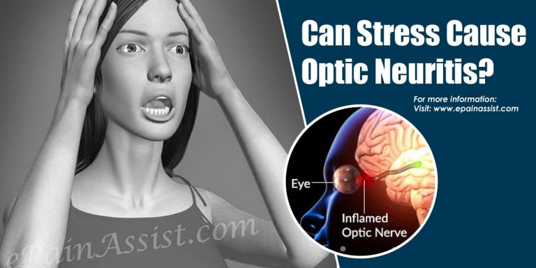Can Stress Cause Optic Neuritis & Does It Cause Headaches?