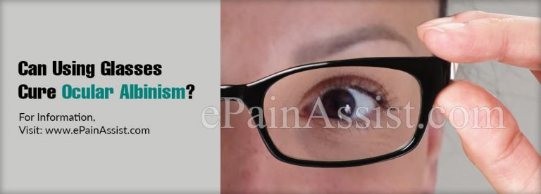 Can Albinism Be Detected Before Birth & Can Using Glasses Cure Ocular Albinism?