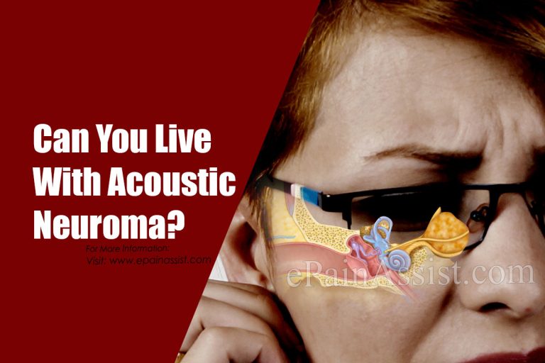 Can You Live With Acoustic Neuroma & How Many Cases Of Acoustic Neuroma Are There?