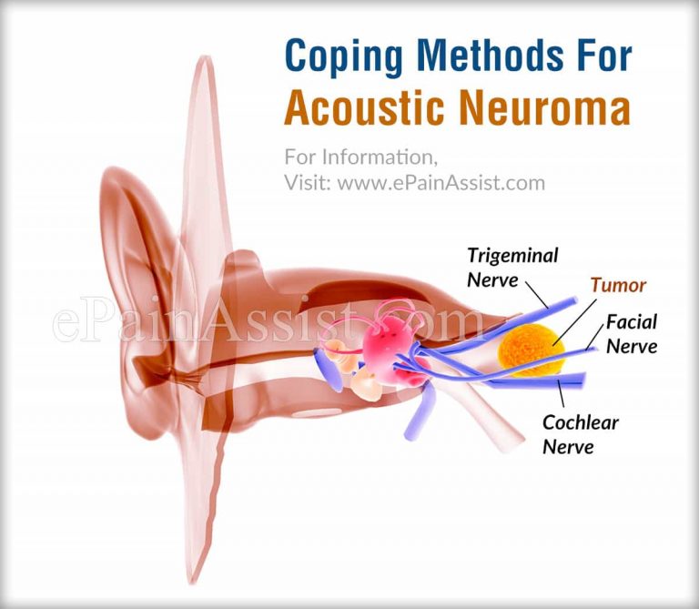 Coping Methods For Acoustic Neuroma