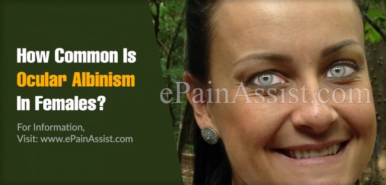 How Common Is Ocular Albinism In Females & Does It Affect Life Span?