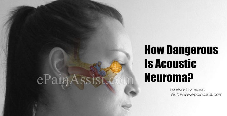 How Dangerous Is Acoustic Neuroma & Is It Contagious?